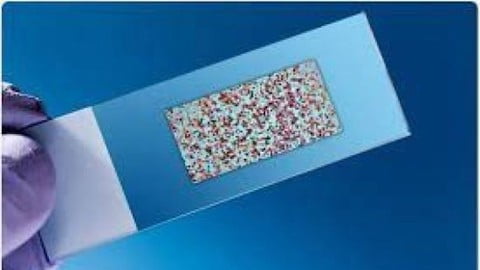 Microarrays analysis for differential gene expression by R